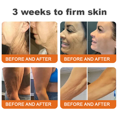 Made and Shipped from UK✨Awzlove® Botox Bee Venom Firming Serum Stick(🔥LAST DAY 80% OFF)💄